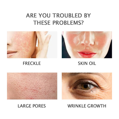 118ML Magic Face Cream: Moisturizing, Hydrating & Deep Nourishing Formula for All Skin Types