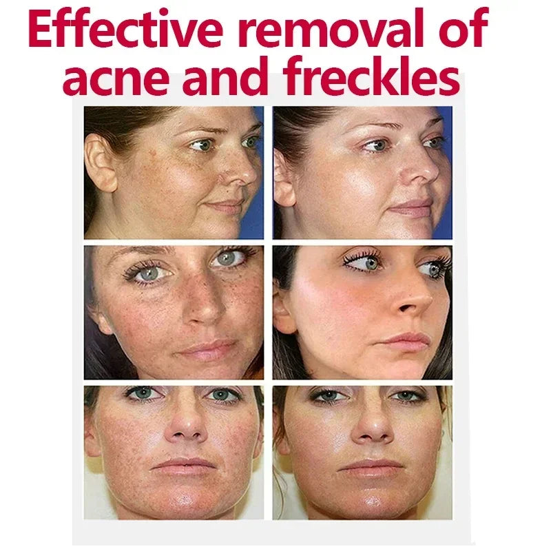 Face Cream Evens Out Skin Tone, Eliminates Dark Spots and Dullness - Non-Greasy, Suitable for Both Men and Women - Whitening an