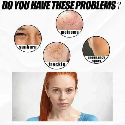 Face Cream Evens Out Skin Tone, Eliminates Dark Spots and Dullness - Non-Greasy, Suitable for Both Men and Women - Whitening an