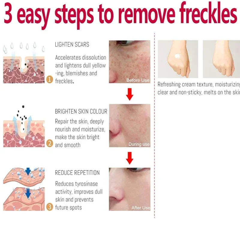Face Cream Evens Out Skin Tone, Eliminates Dark Spots and Dullness - Non-Greasy, Suitable for Both Men and Women - Whitening an