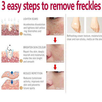 Face Cream Evens Out Skin Tone, Eliminates Dark Spots and Dullness - Non-Greasy, Suitable for Both Men and Women - Whitening an